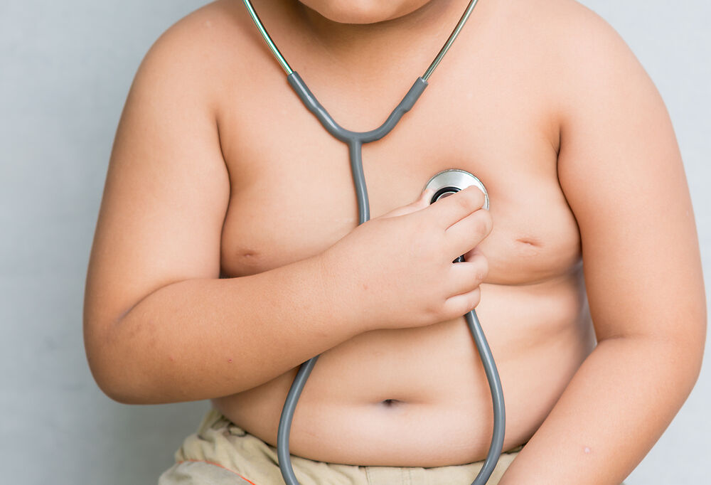 Nguyên nhân, cách phòng tránh và điều trị béo phí ở trẻ